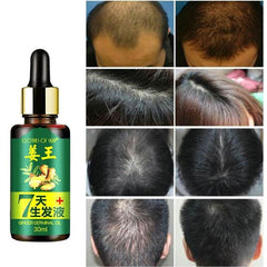 Unisex Hair Growth Serum Essence Anti Hair Loss