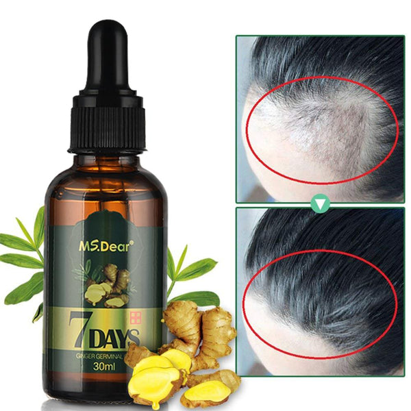 Hair Growth Essential Oils Ginger Germinal Oil